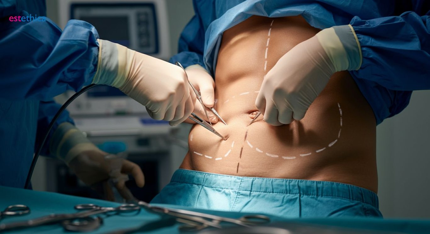 Abdominal etching before and after results
