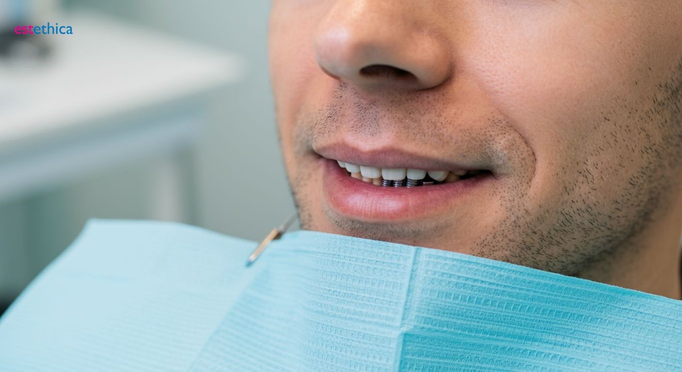 Ideal candidate profile for dental implants