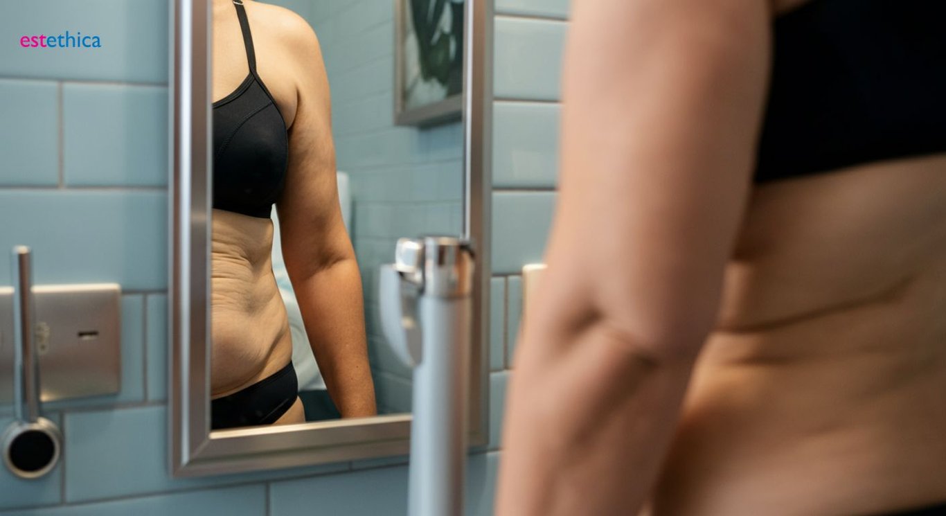 Body contouring after tummy tuck for ideal silhouette