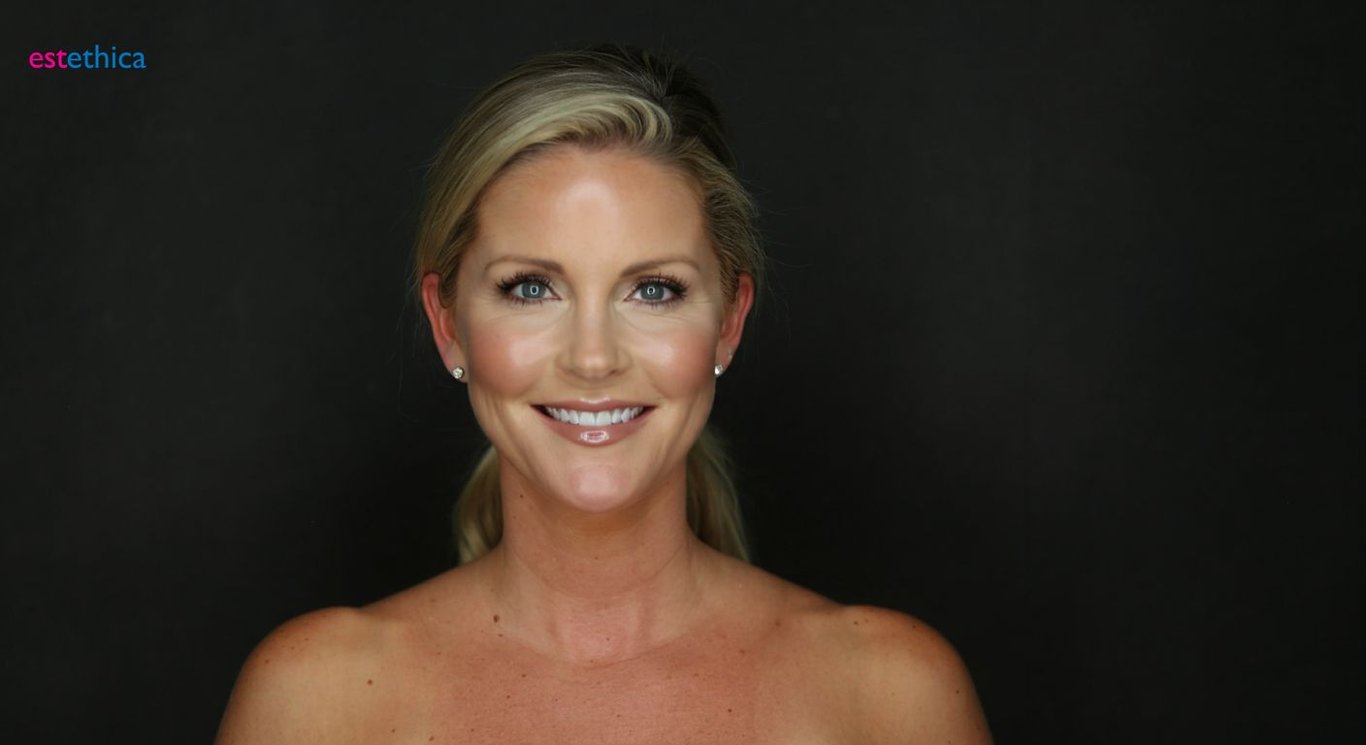 Breast implant surgery procedure and recovery overview
