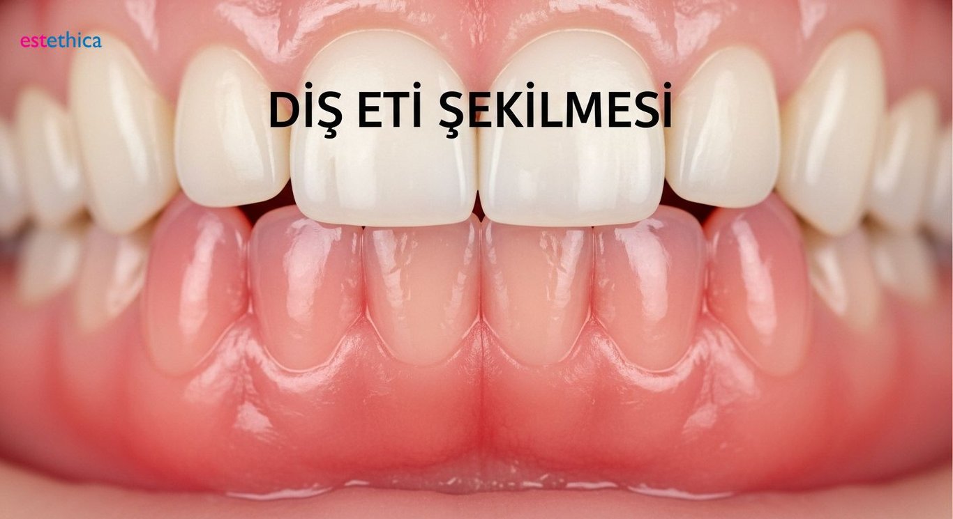Diş eti çekilmesi nedenleri ve risk grupları