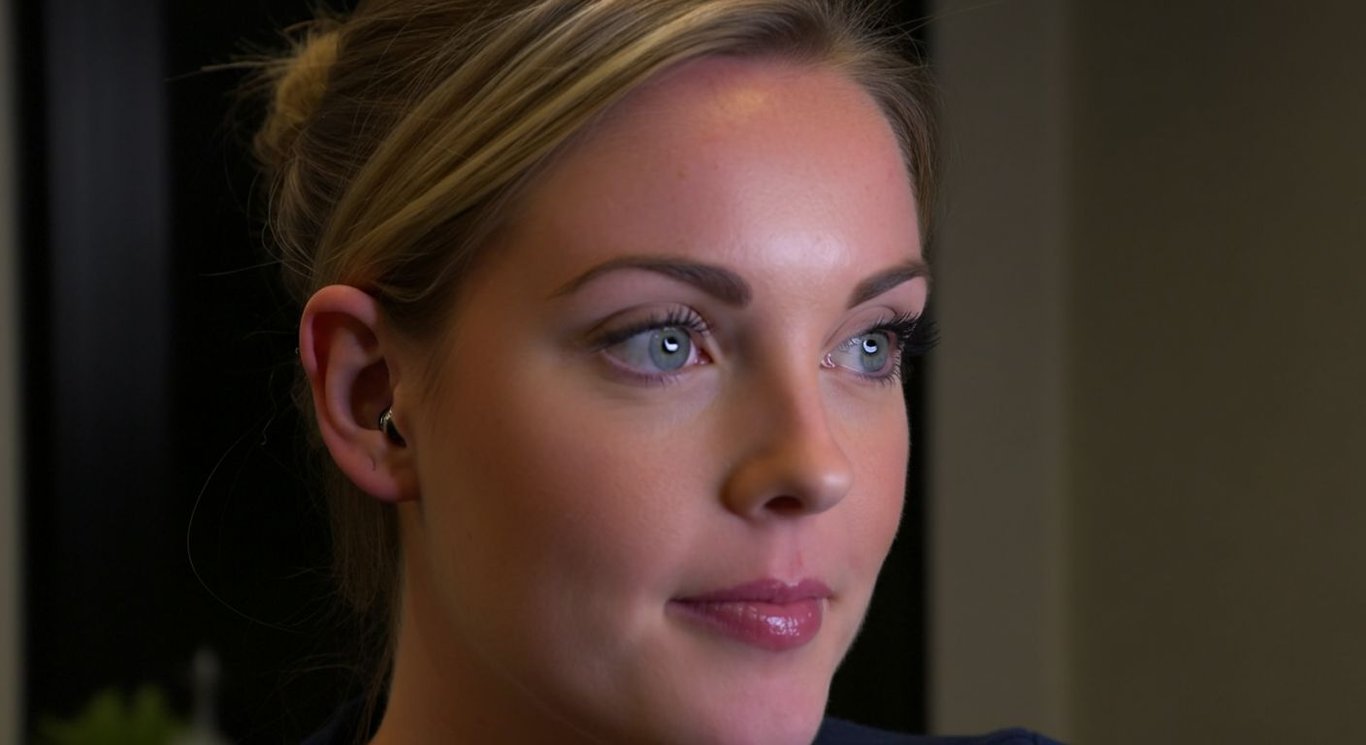 Ear reshaping transformation from prominent to perfect
