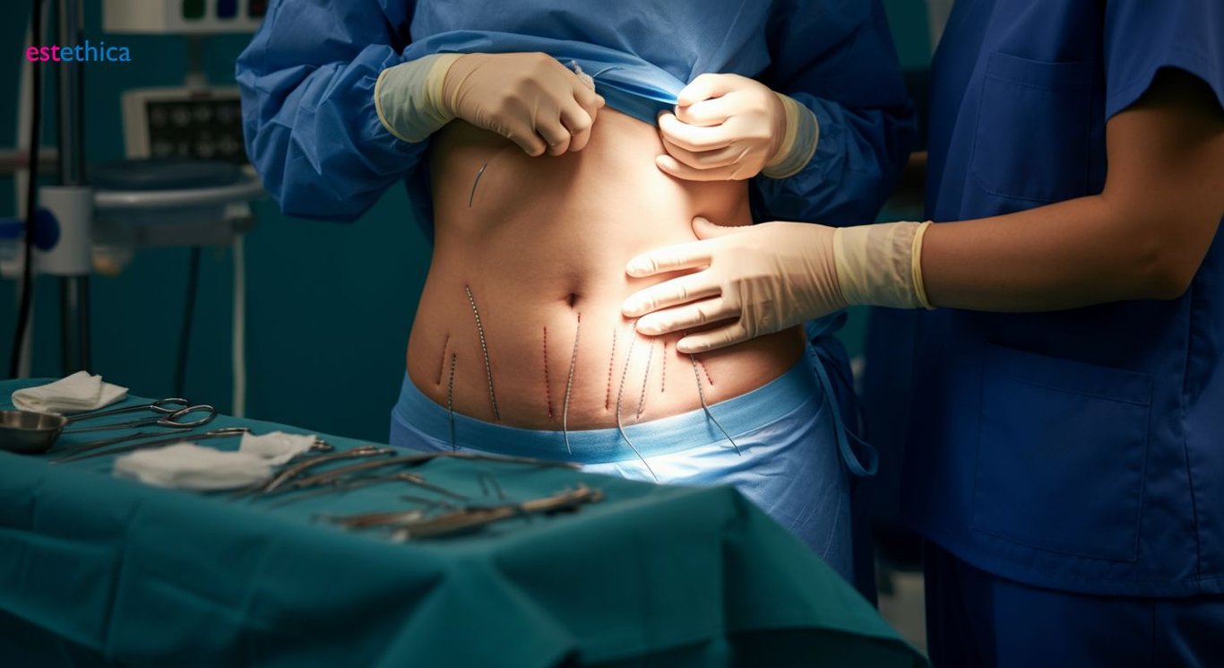 Karın germe ameliyatı süreci adımları