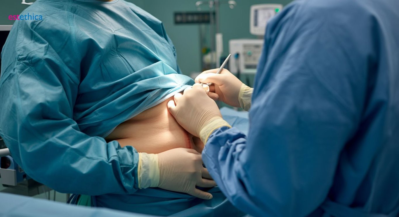 Karın germe ameliyatı süreci ve iyileşme rehberi