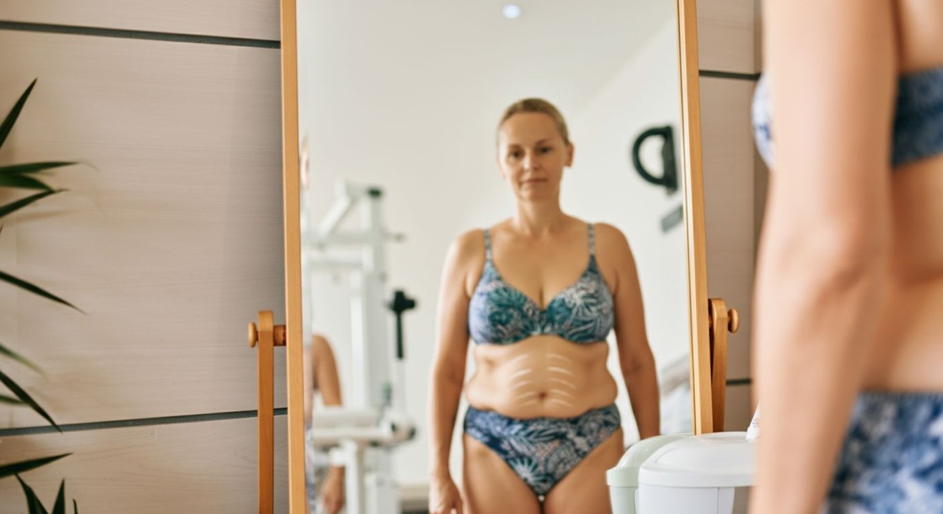 Liposuction recovery day-by-day guide