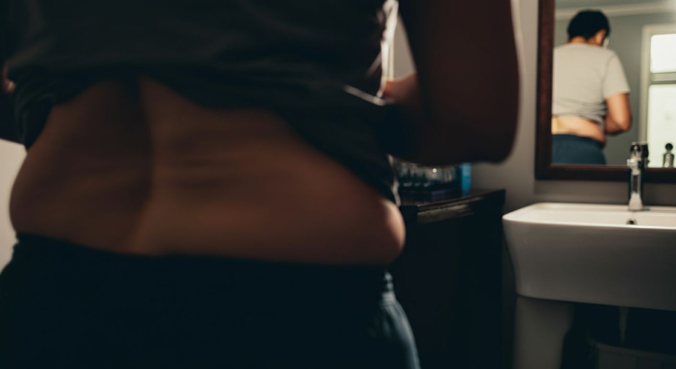 Mommy Makeover: Tummy Tuck and Other Procedures