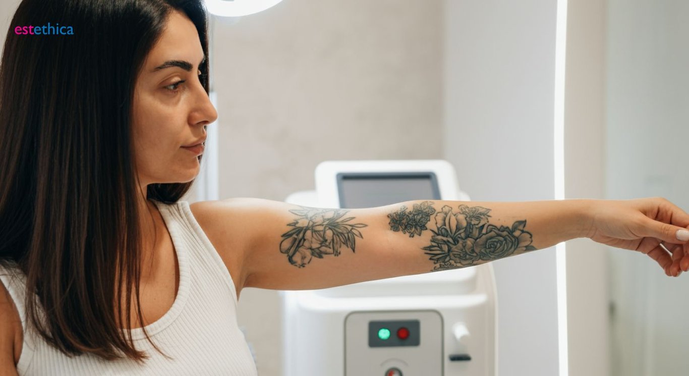 Q-Switch ve Pikosek Lazer ile dövme renklerinden kurtulma