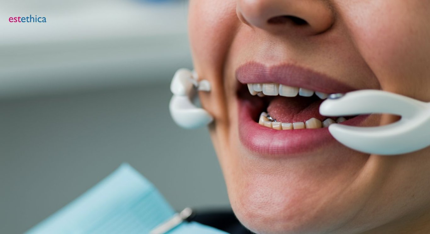 Dental implant procedure step-by-step insights