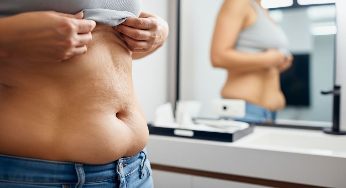 Tummy Tuck Procedure: Abdominoplasty Steps