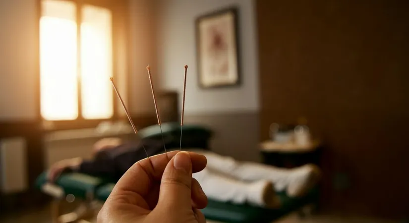 Choosing the Best Acupuncture Needles for Beginners