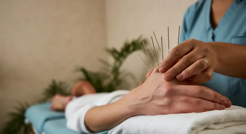 Affordable Acupuncture Services Nearby: What to Expect