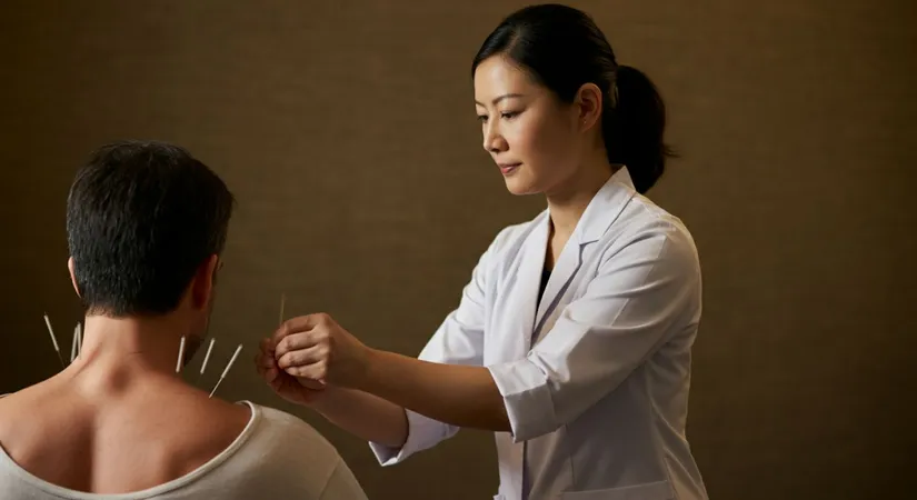 Acupuncture for stress relief