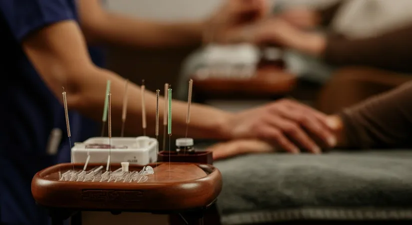 Finding the Best Acupuncture Clinics in London